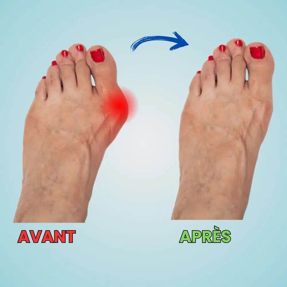 Semelles OrthoStep™ - Une journée entière sans douleur