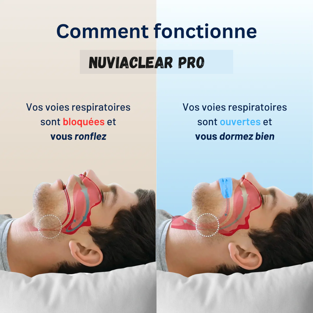 NuviaClear™  La Solution N°1 Contre le Ronflement